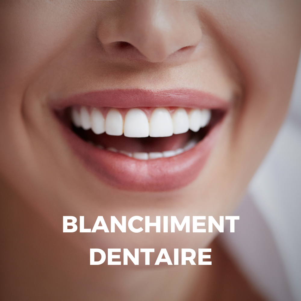 Institut de beauté Cagnes-sur-mer blanchissement dentaire